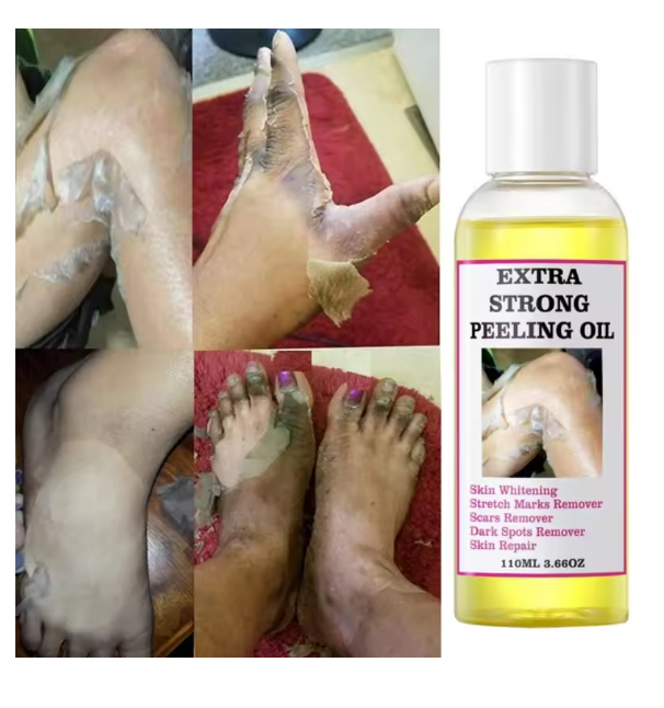 Peeling Oil