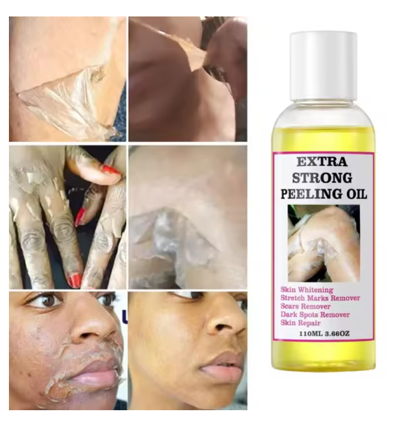 Peeling Oil